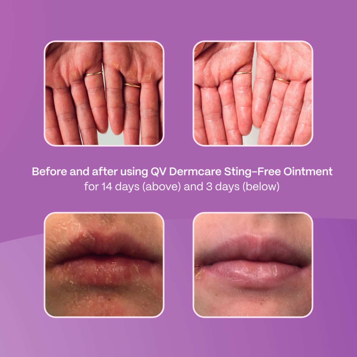 Thumbnail Ego QV Dermcare Sting-Free Ointment 200g