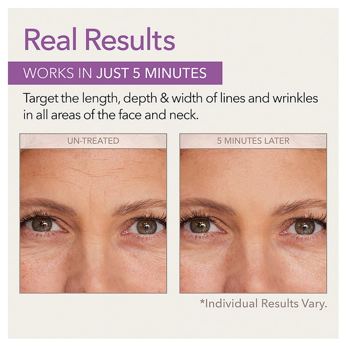 Thumbnail Skin Doctors Instant Wrinkle Filler 10ml