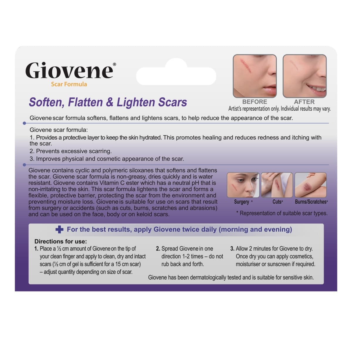 Thumbnail Giovene Scar Treatment 15g