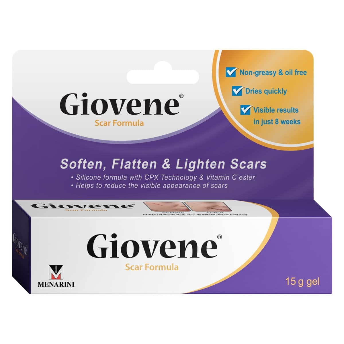 Thumbnail Giovene Scar Treatment 15g