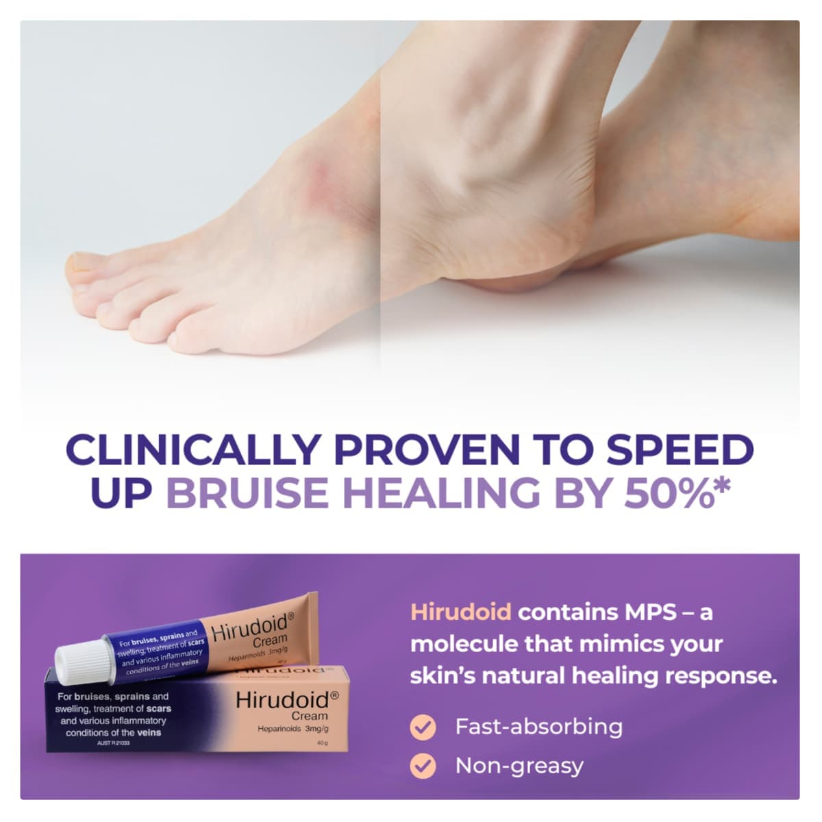 Thumbnail Hirudoid Cream for Bruises 40g
