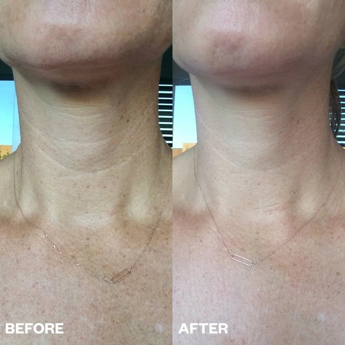 Thumbnail Wrinkles Schminkles Neck Wrinkle Patch Single