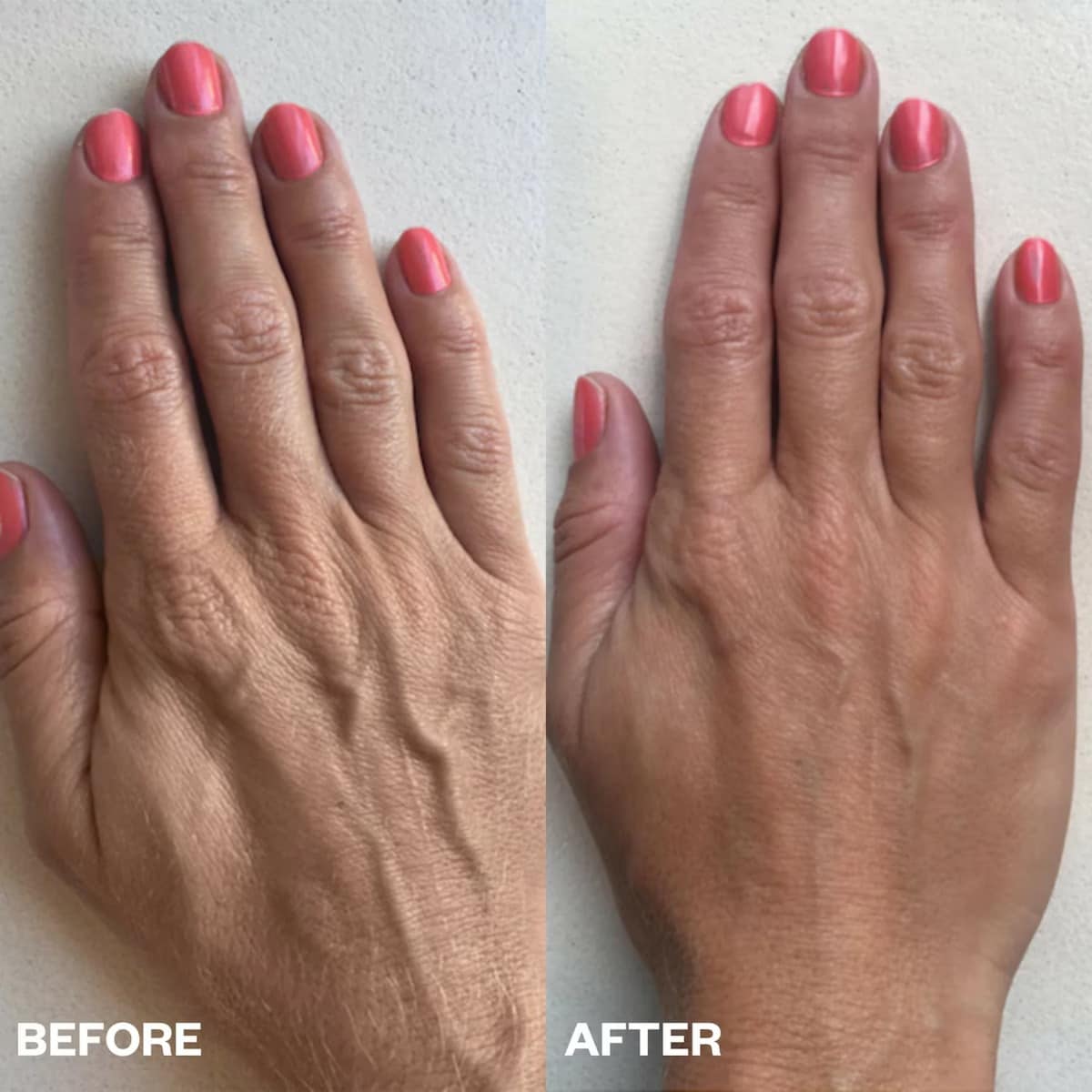 Thumbnail Wrinkles Schminkles Hand Wrinkle Patches - One Pair