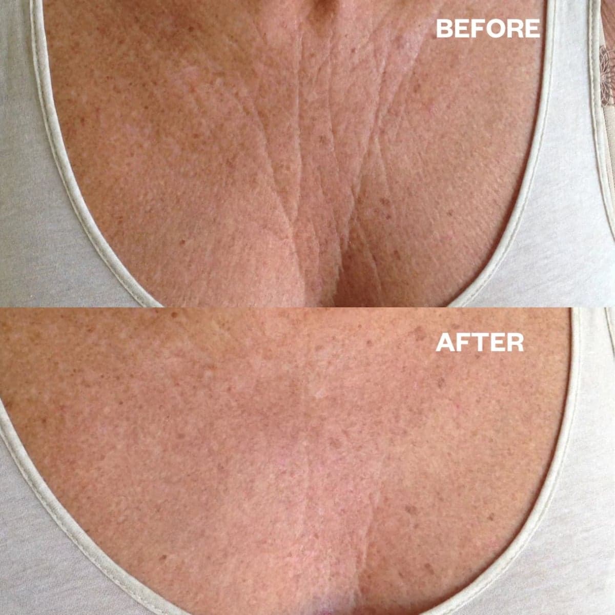 Thumbnail Wrinkles Schminkles Chest Wrinkle Patch Single