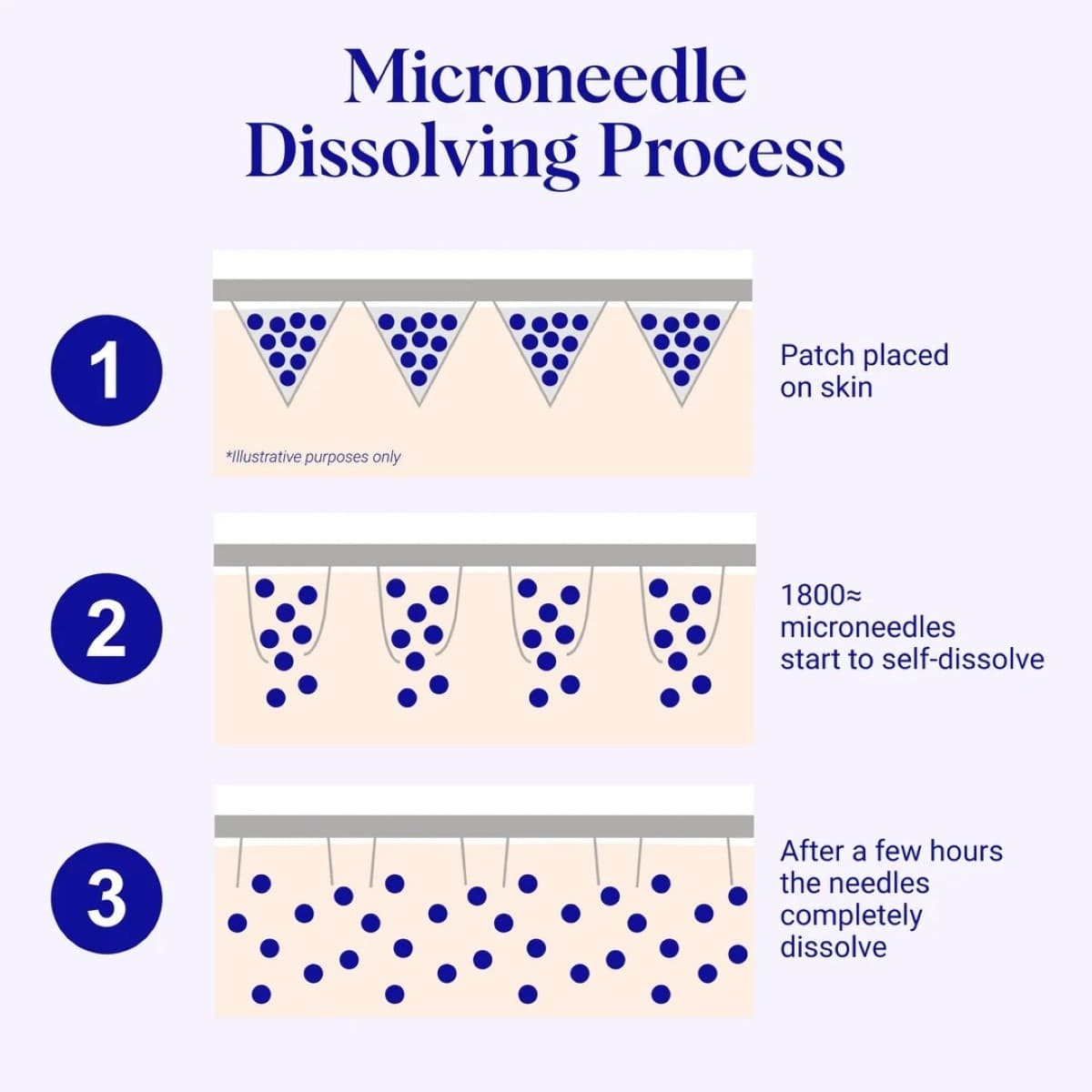 Thumbnail Wrinkles Schminkles Self-Dissolving Microneedle Patches - 4 Pack