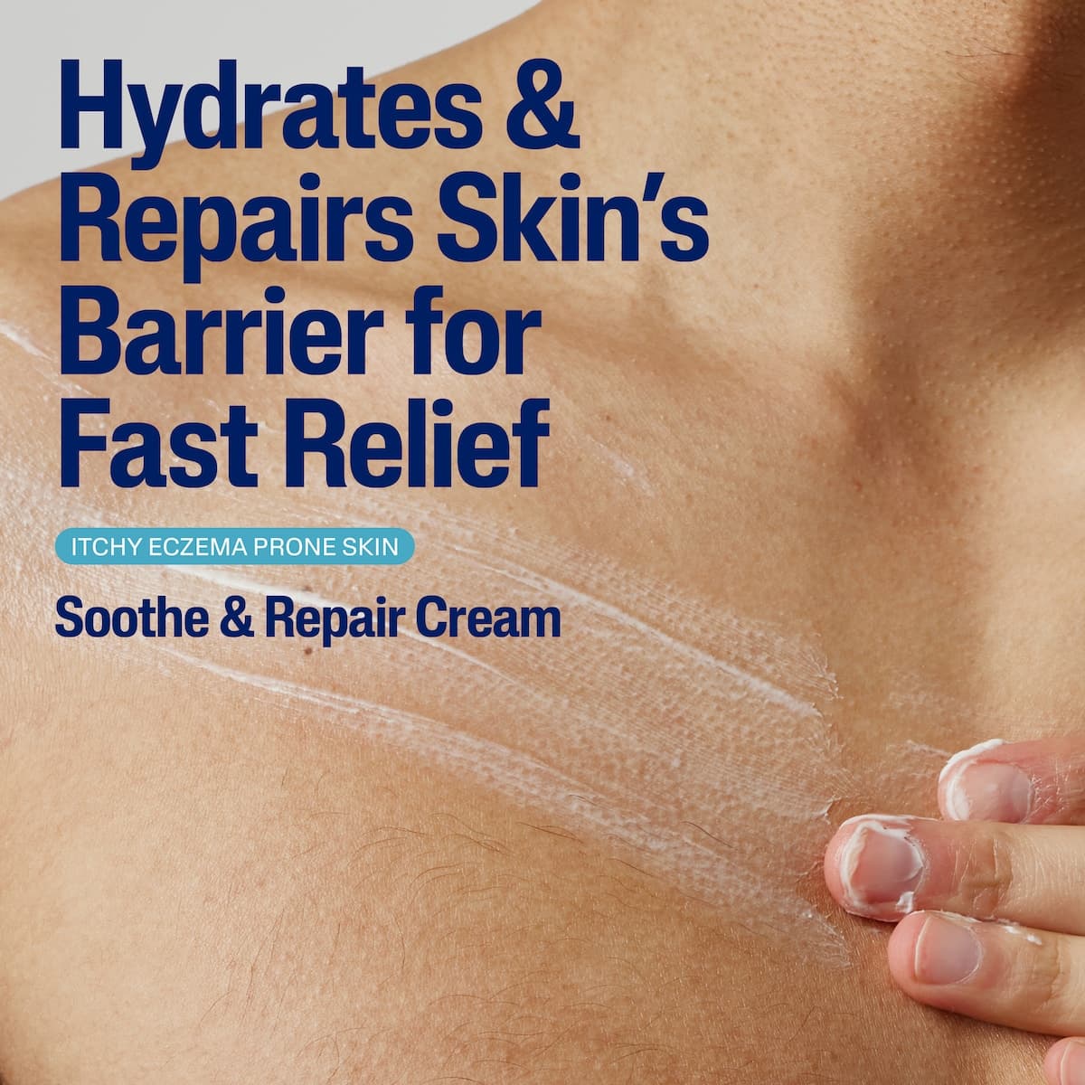 Thumbnail Cetaphil Pro Eczema Prone Soothe & Repair Cream 226g