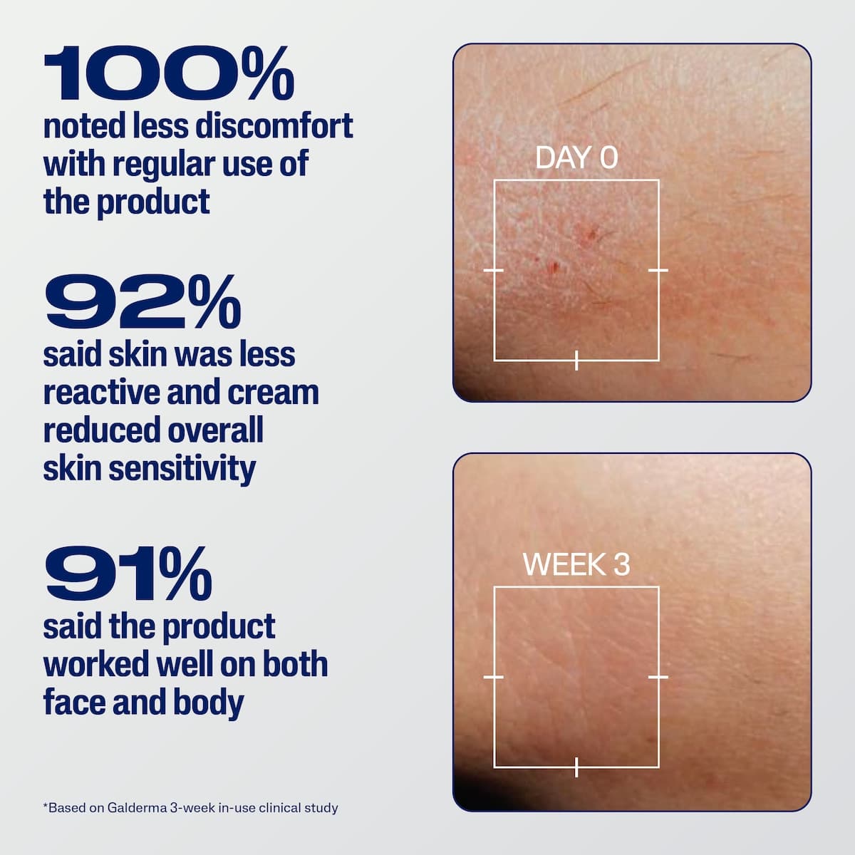 Thumbnail Cetaphil Pro Eczema Prone Soothe & Repair Cream 226g