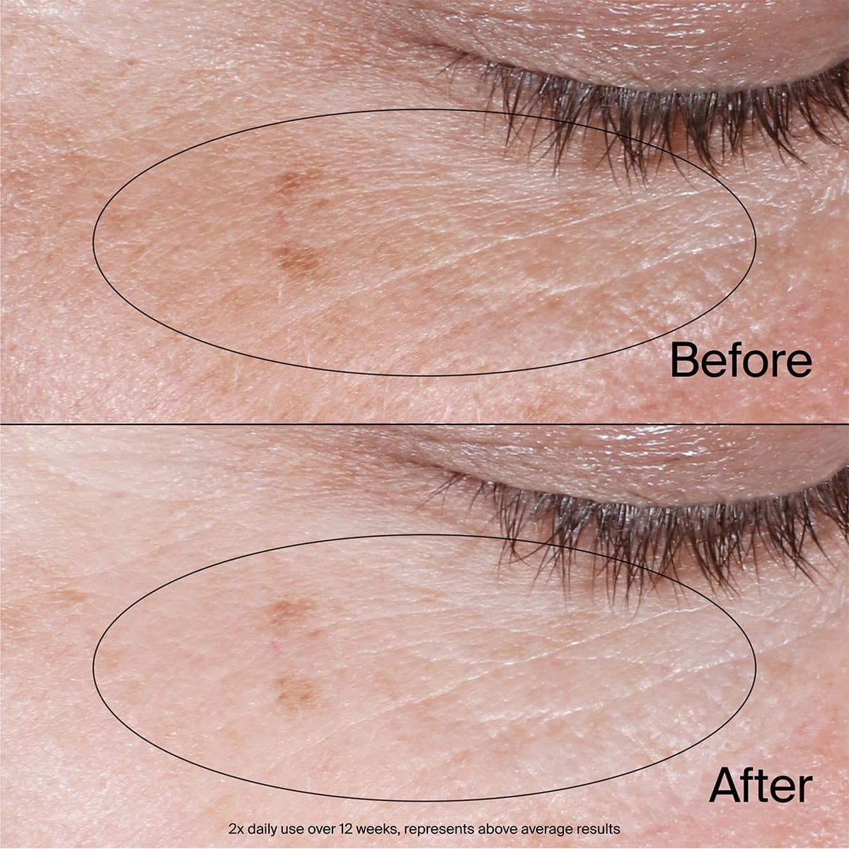 Thumbnail Neutrogena Collagen Bank Reviving Eye Gel Cream 14g