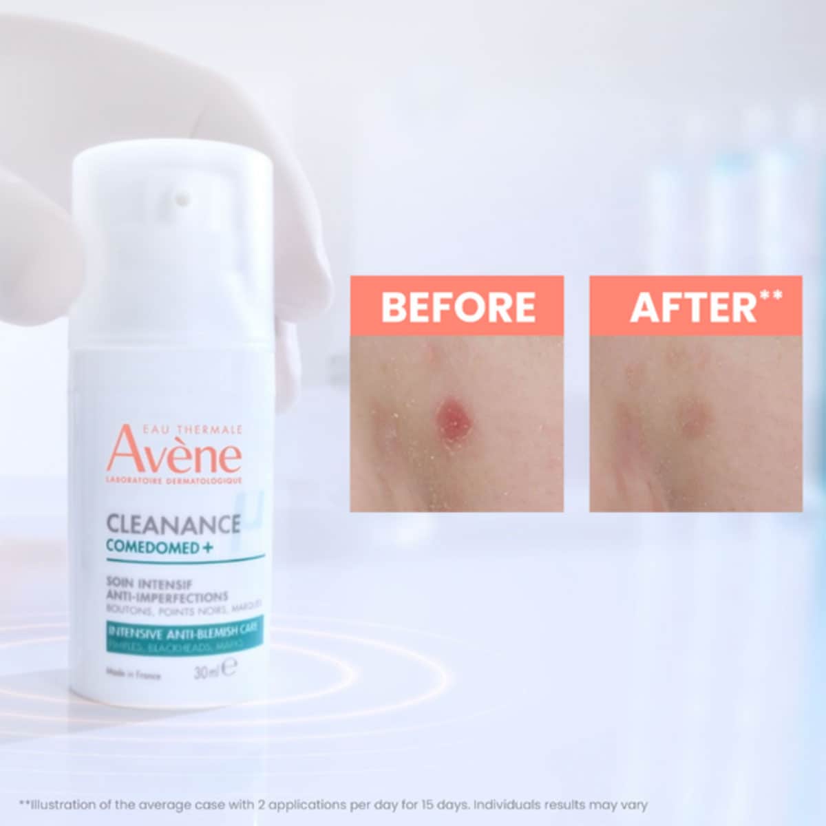 Thumbnail Avene Cleanance Comedomed+ Intensive Anti-Blemishe Care 30mL