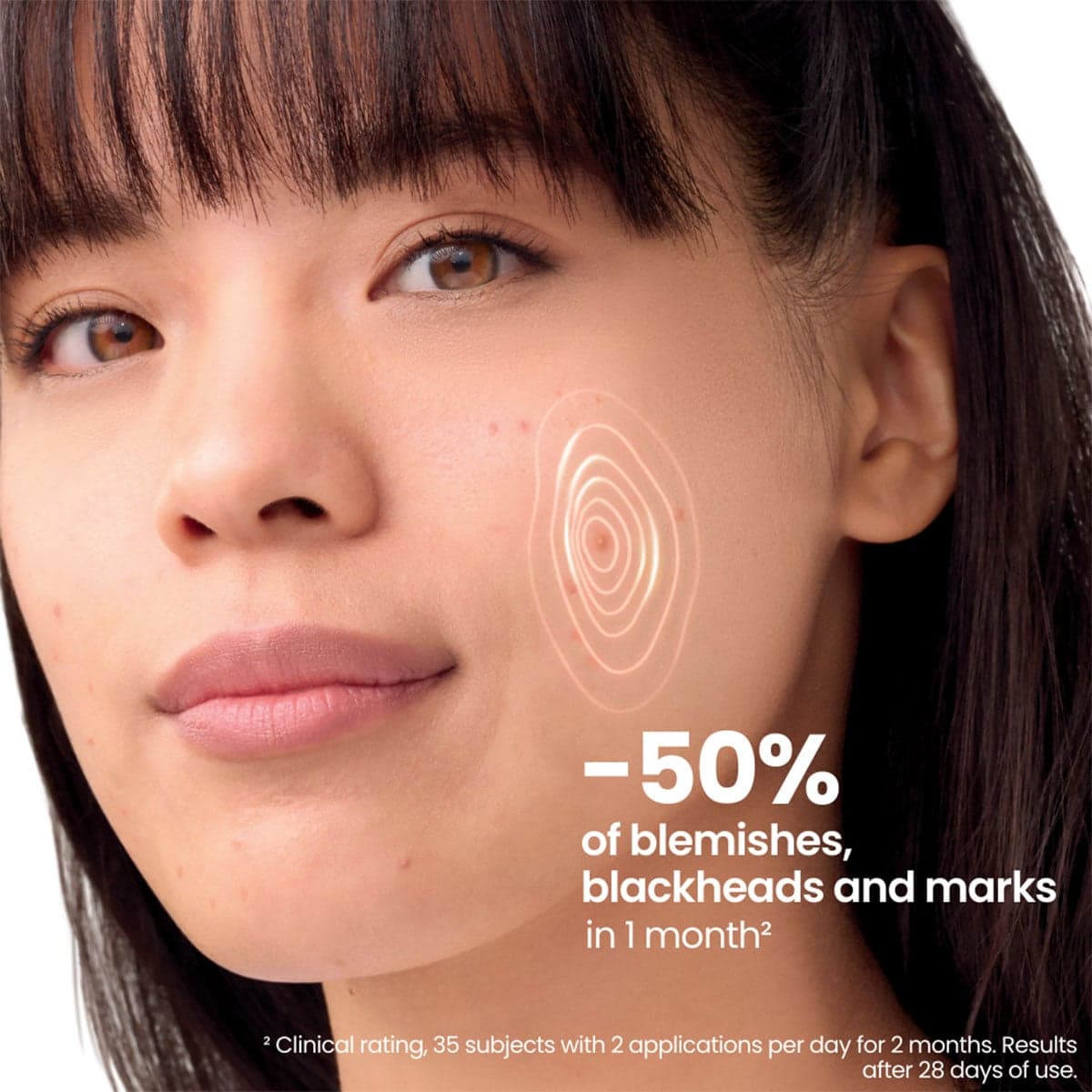 Thumbnail Avene Cleanance Comedomed+ Intensive Anti-Blemishe Care 30mL