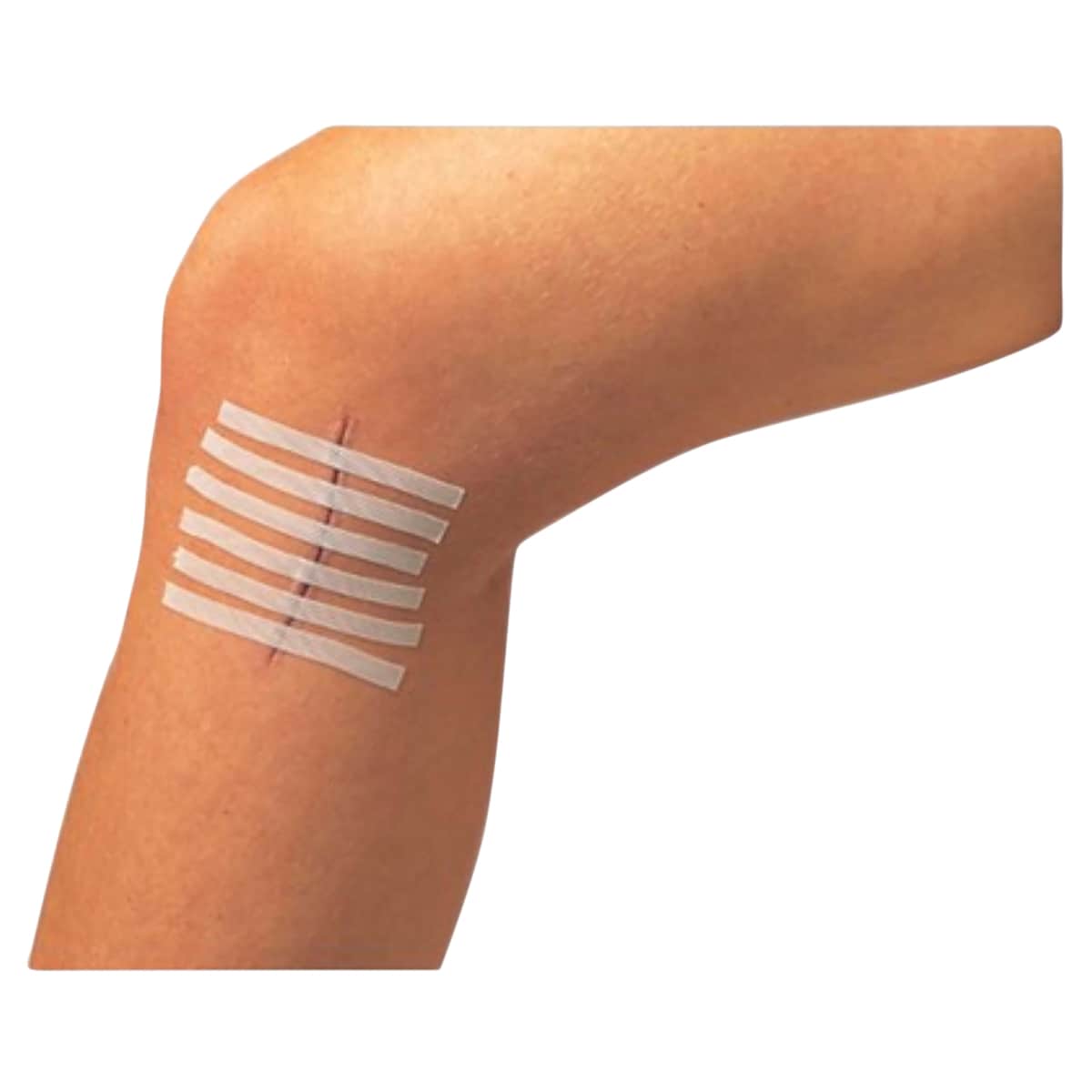 Thumbnail Leukostrip Wound Closure Strips 6.4mm x 76mm - Single (3 Strips)