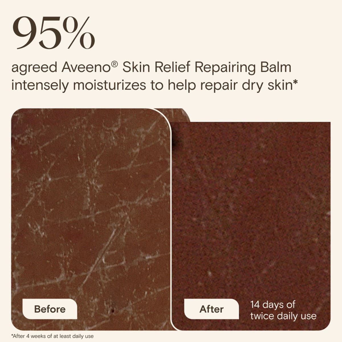 Thumbnail Aveeno Skin Relief Repairing Balm 75mL