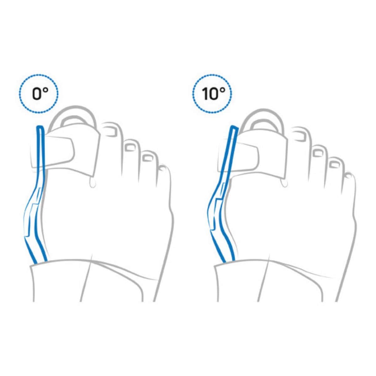 Thumbnail Aircast ActyToe Bunion Splint M