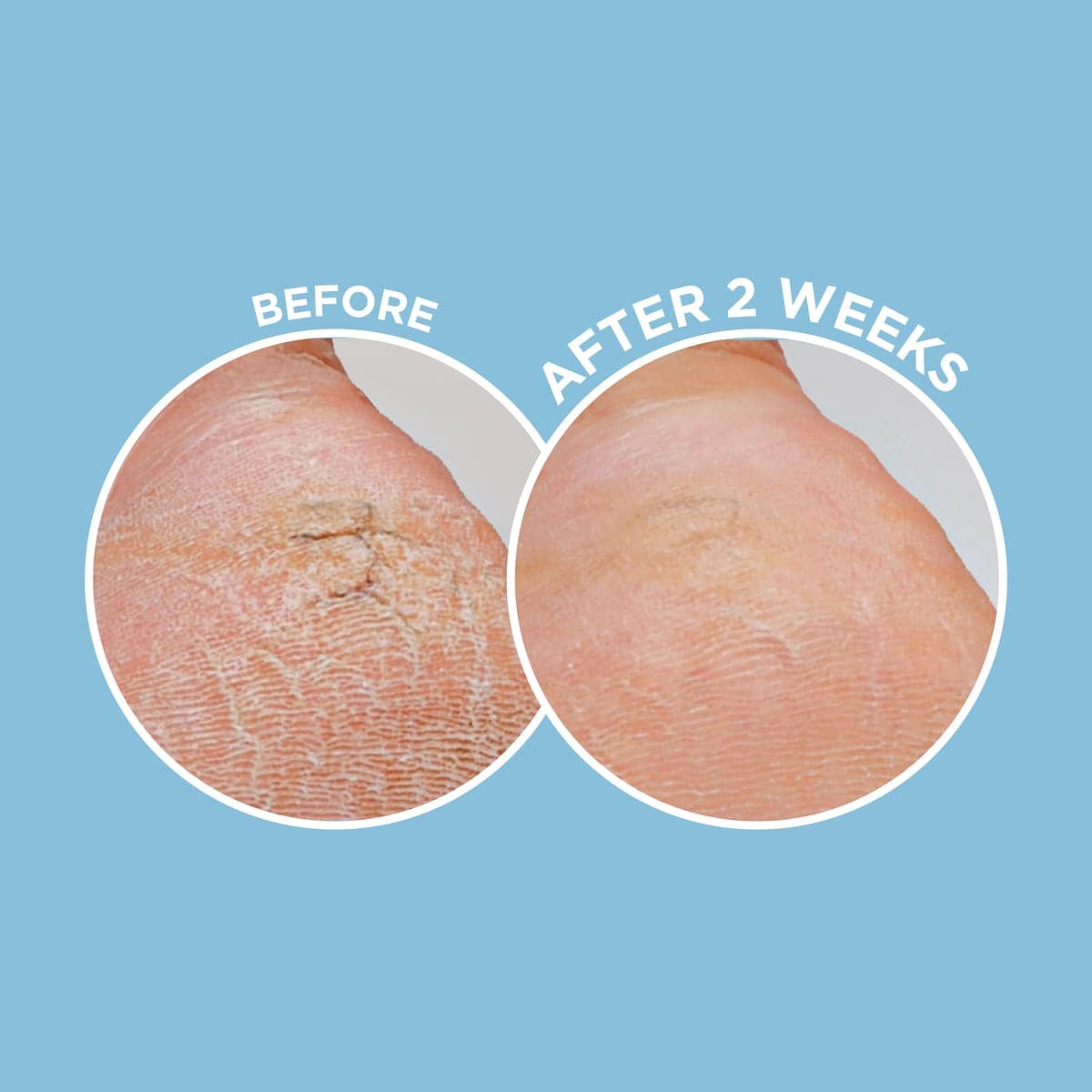 Thumbnail Dermal Therapy Heel Magic 70g