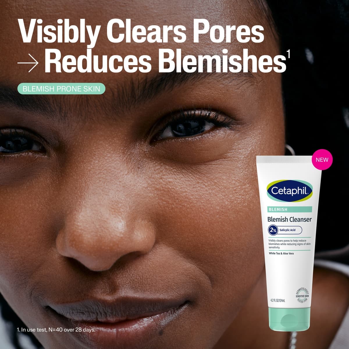 Thumbnail Cetaphil Blemish Cleanser 124mL