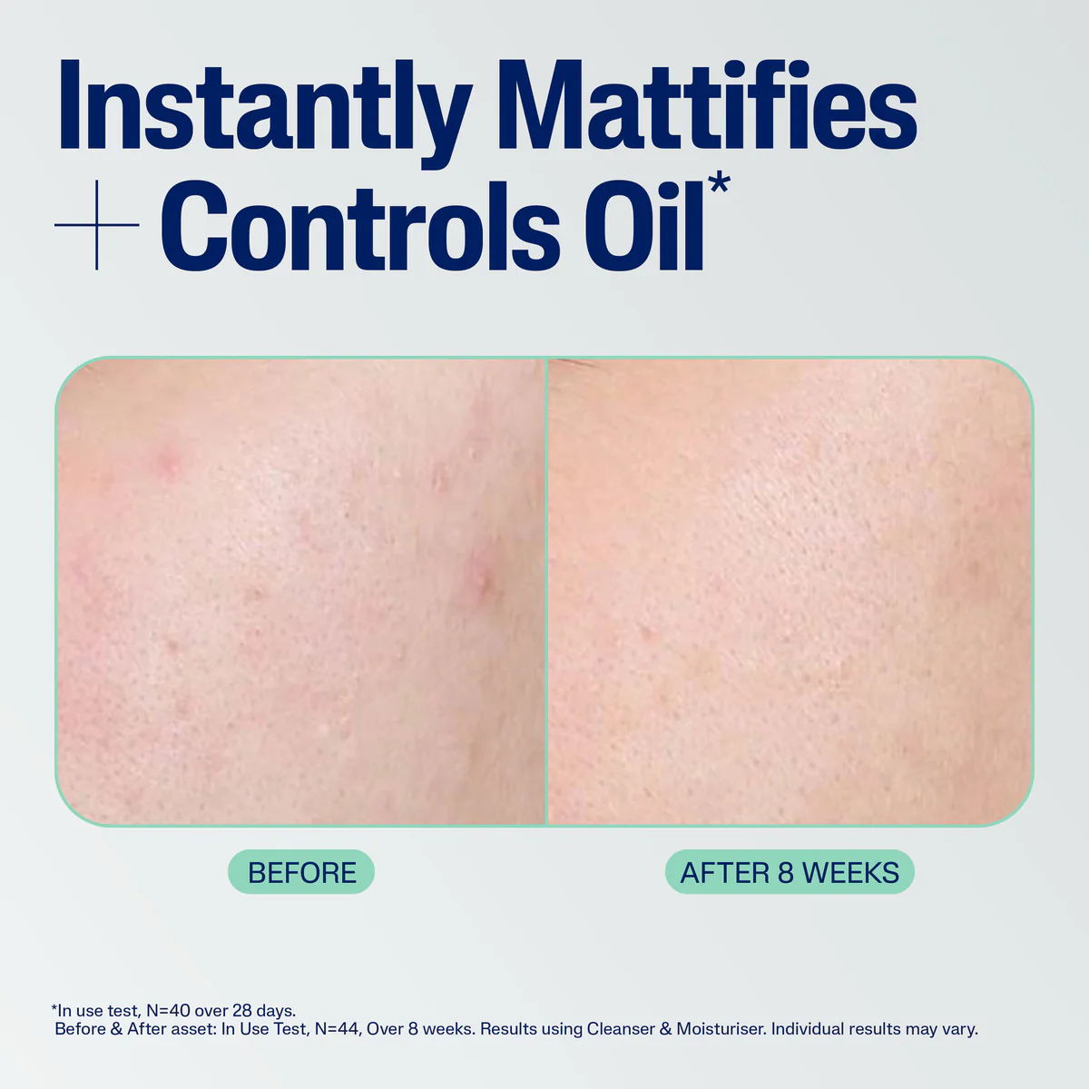 Thumbnail Cetaphil Mattifying Blemish Moisturiser 100mL