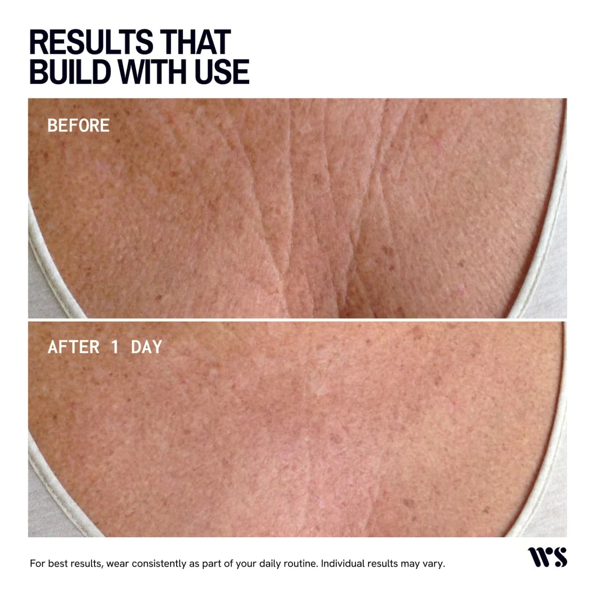 Thumbnail Wrinkles Schminkles Chest Wrinkle Patch Single