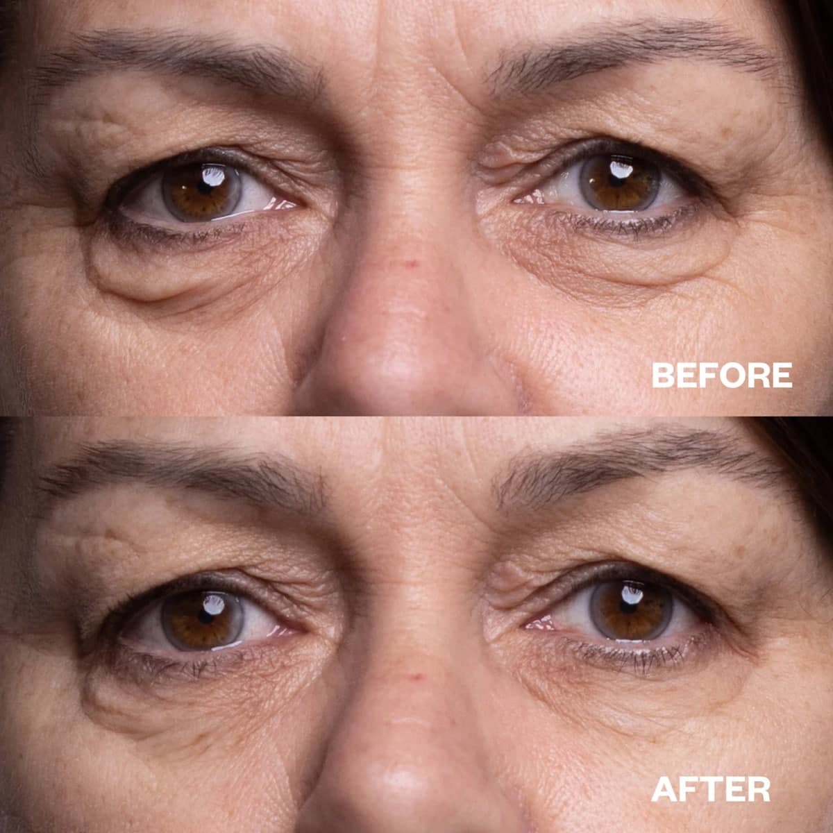 Thumbnail Wrinkles Schminkles Eye Wrinkle Patches - One Pair