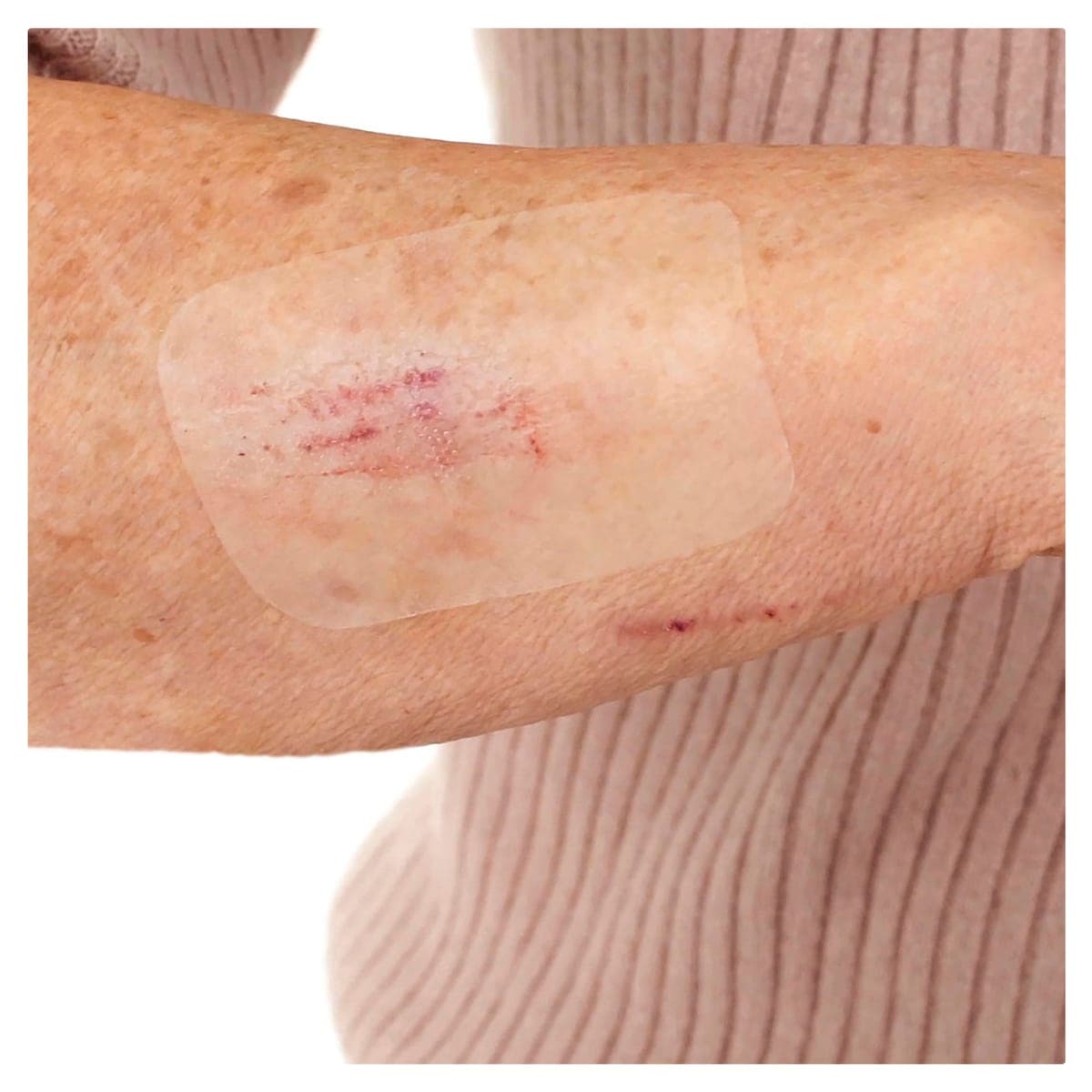 Thumbnail Leukoplast Leukomed T Skin Sensitive 5cm x 7.2cm 5 Pack