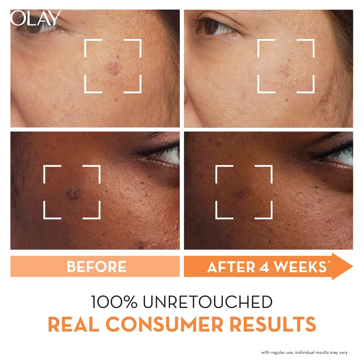Thumbnail Olay Luminous Niacinamide + Vitamin C Face Super Serum 30ml