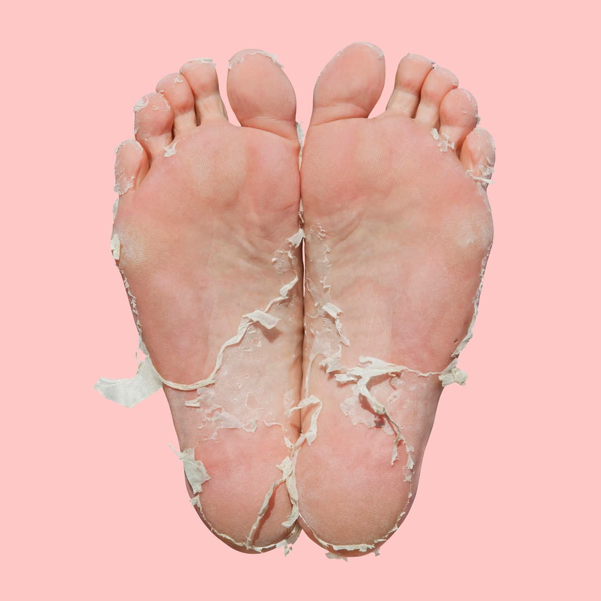 Thumbnail Skin Republic Foot Peel (2 Booties)