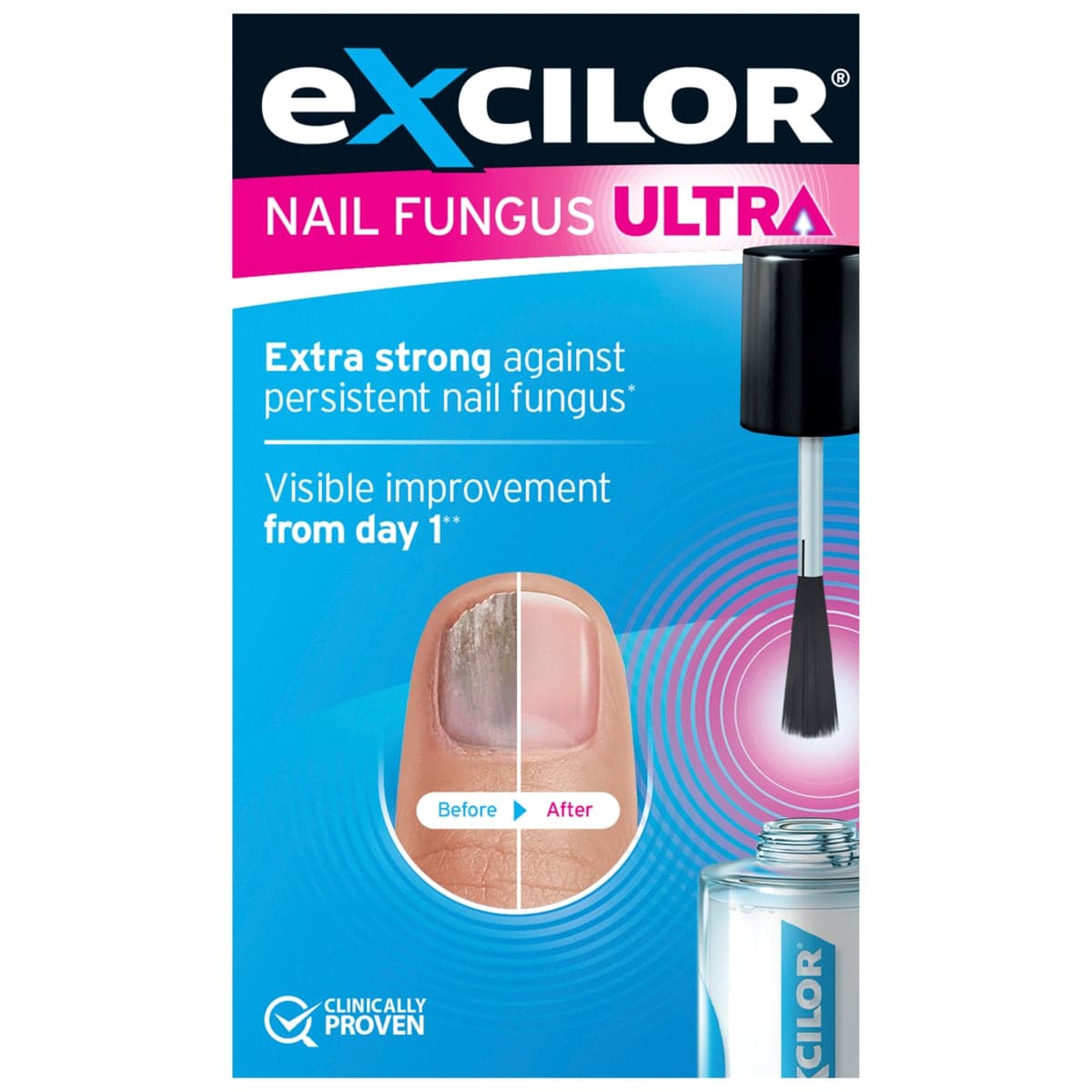 Excilor Ultra Fungal Nail Treatment 30ml