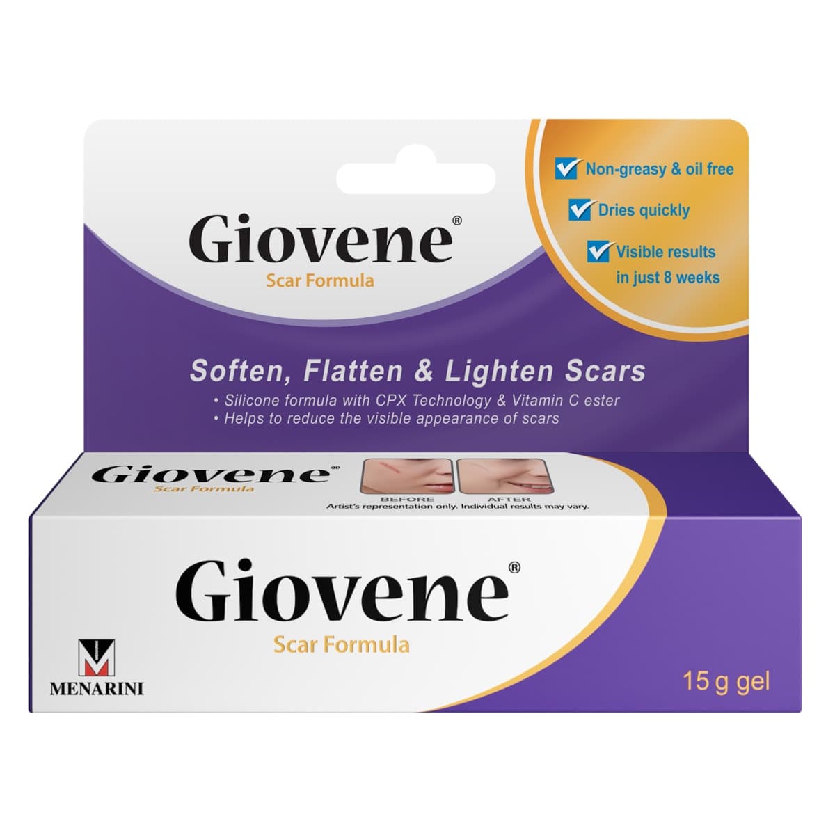 Giovene Scar Treatment 15g