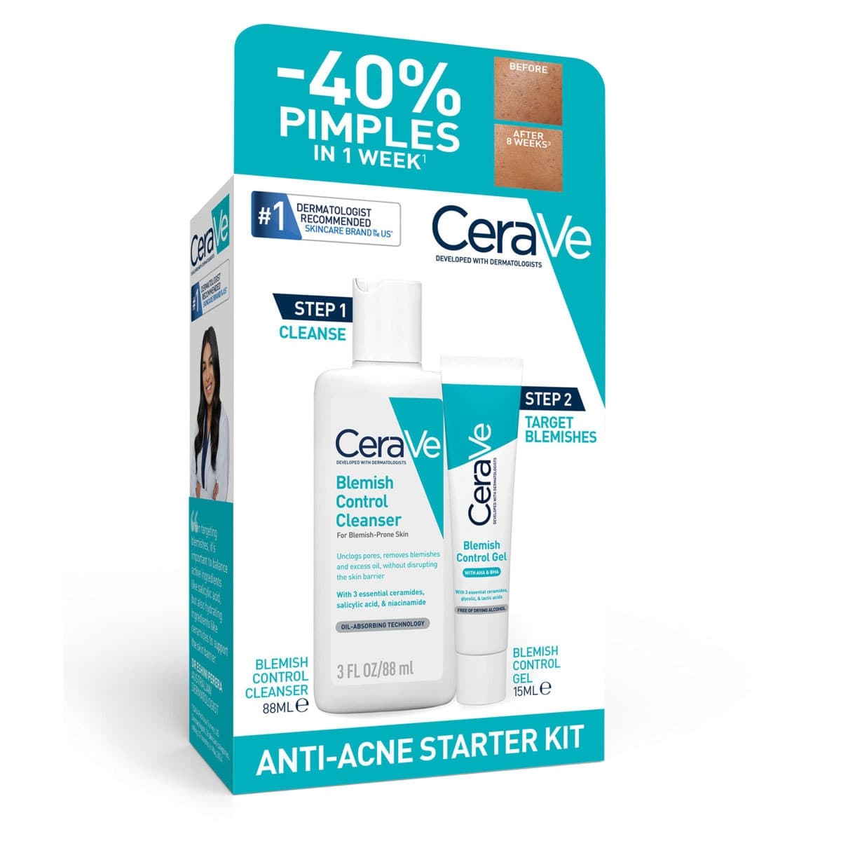CeraVe Anti Acne Starter Kit