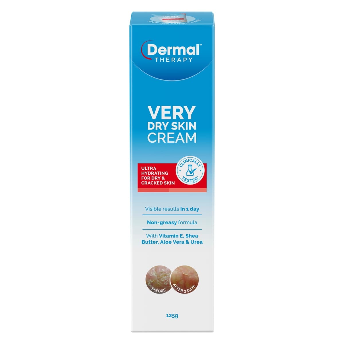 Dermal Therapy Very Dry Skin Cream 125g