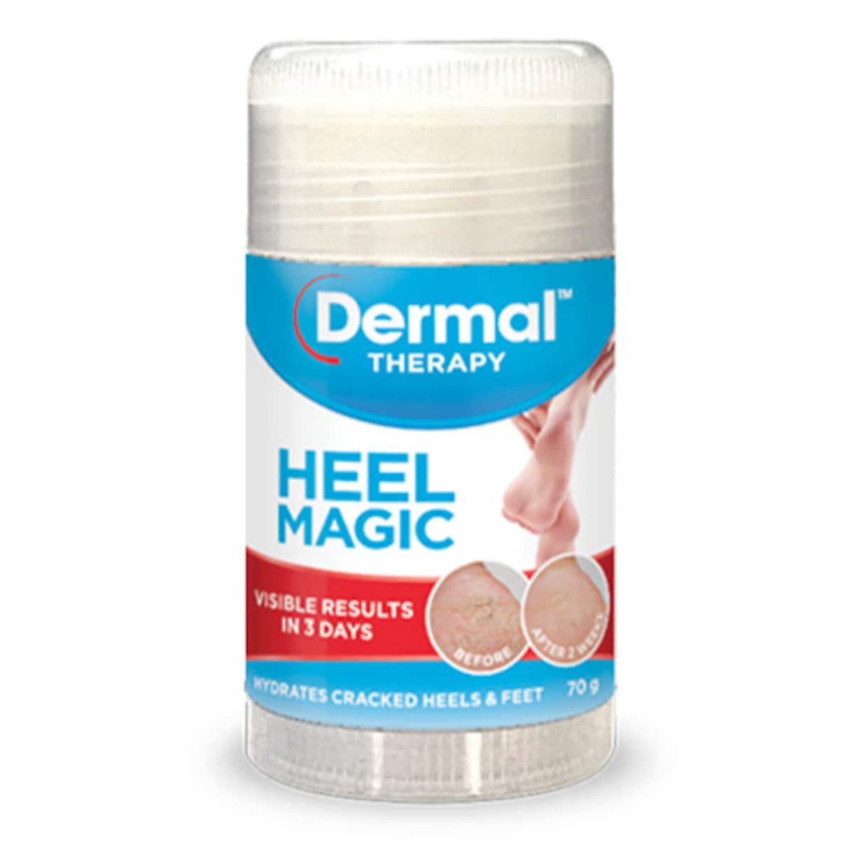 Dermal Therapy Heel Magic 70g