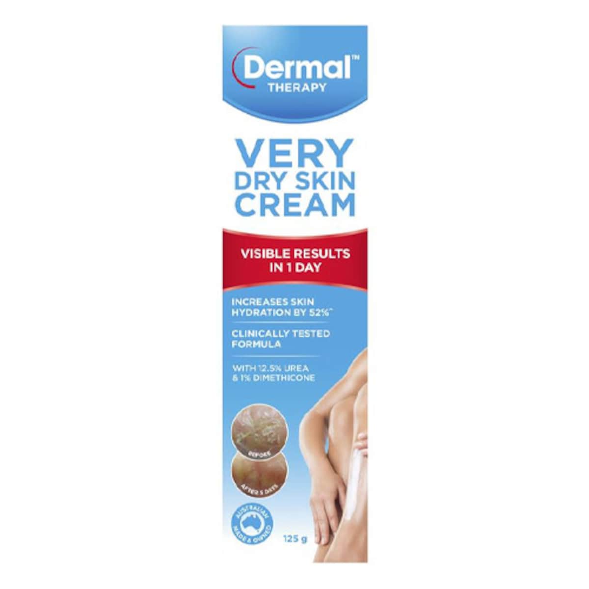 Dermal Therapy Very Dry Skin Cream 125g